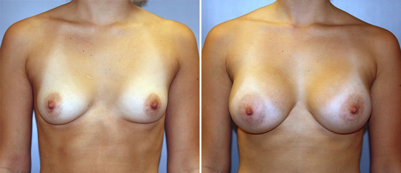 story about penis plug real or fake breasts tits