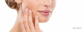 Juvederm Model Juvederm Model